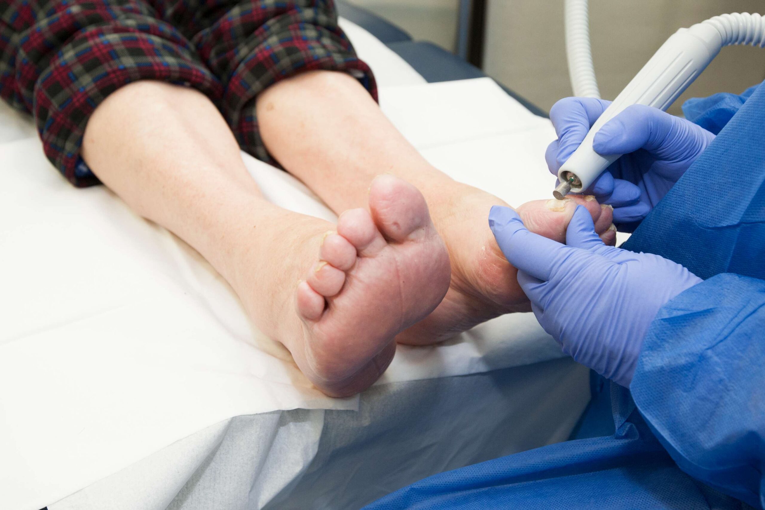 Quand consulter pour des soins de pieds à Gatineau ?